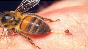 سم النحل لعلاج الصداع النصفي 